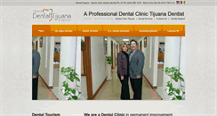 Desktop Screenshot of clinicadentaltijuana.com